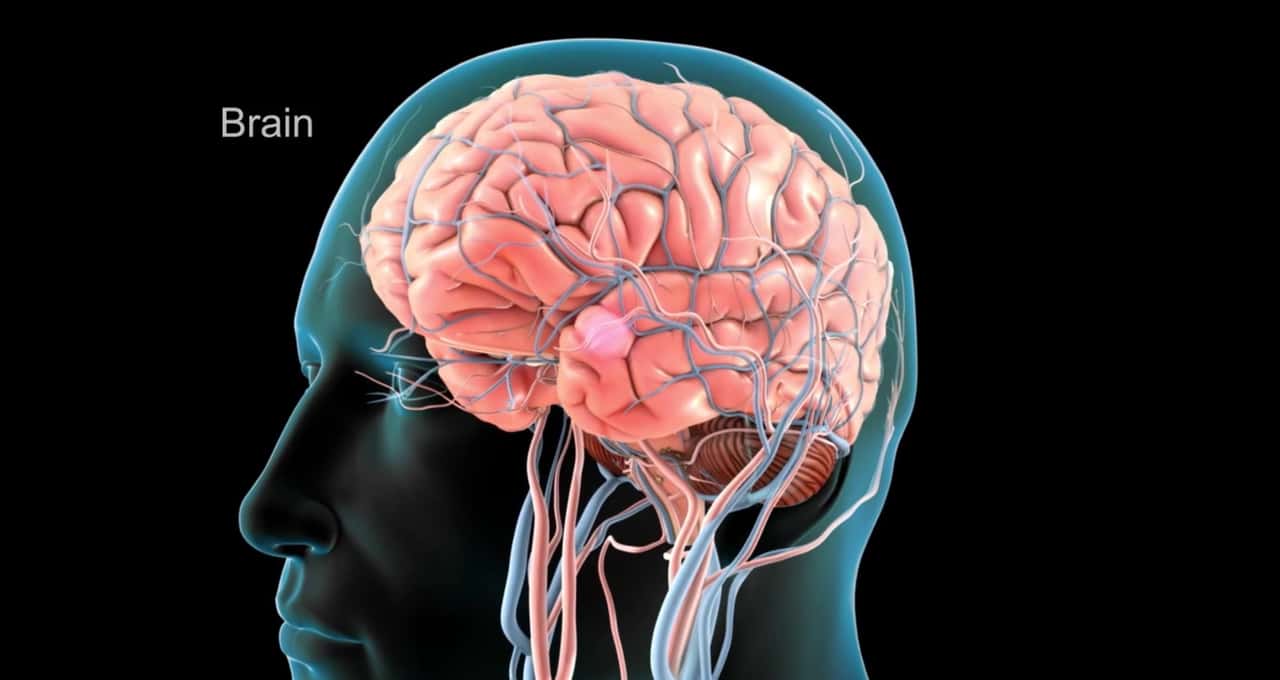 Dor de cabeça pode ser sintoma de aneurisma cerebral; saiba quando isso pode acontecer