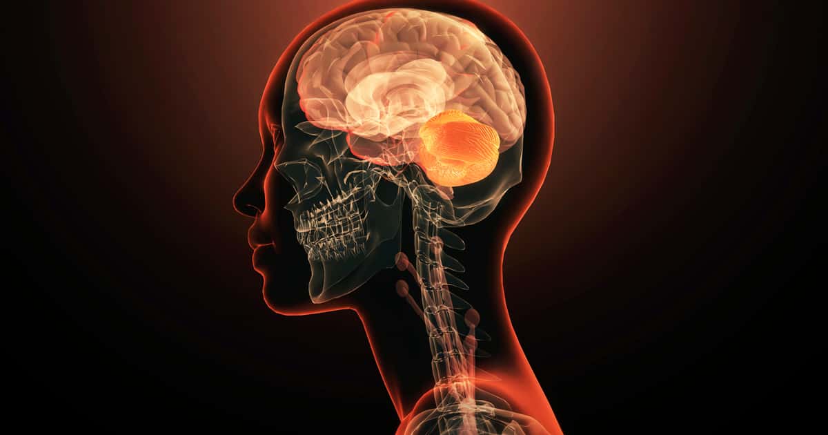 Pacientes com Alzheimer passam a ter novo tratamento no SUS