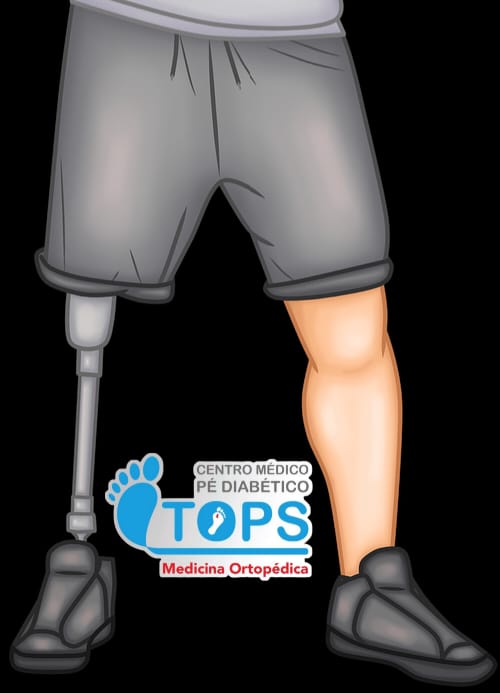 Amputação e Diabetes.