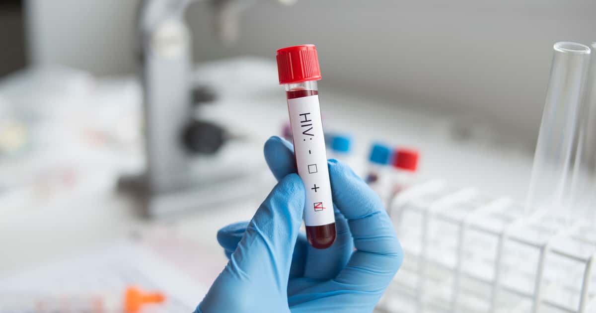 Saiba como o corpo reage na fase aguda do HIV