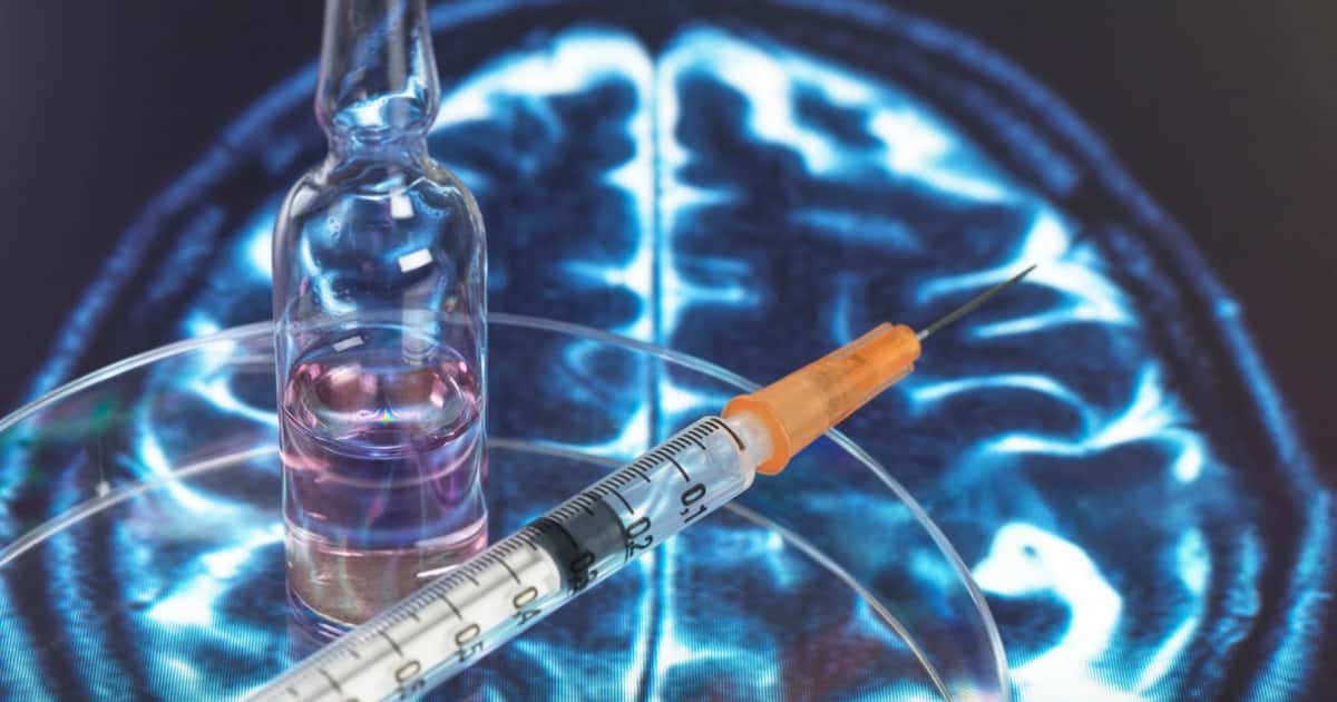 Trânsito intenso pode afetar seu cérebro mais do que você imagina