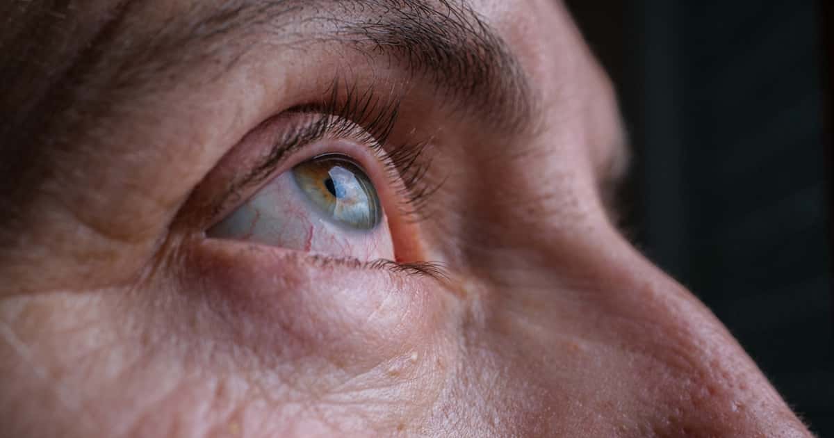 Um indicador nos olhos pode ajudar a identificar esquizofrenia, aponta pesquisa