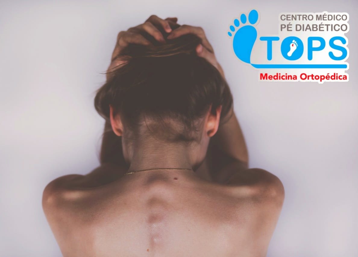 Manifestações musculoesqueléticas comuns em pessoas com Diabetes – COLUNA e OSTEOPOROSE.