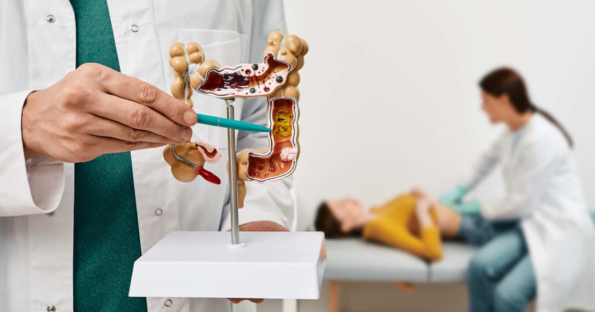A vitamina do brócolis que pode ajudar a prevenir o câncer de intestino